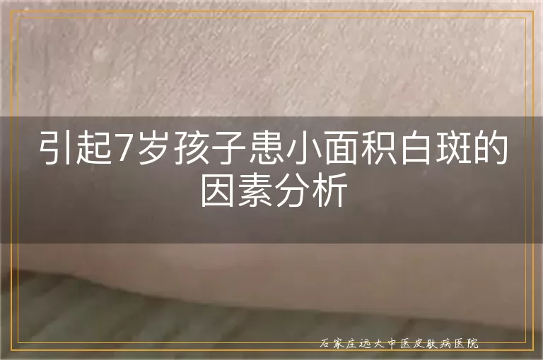 引起7岁孩子患小面积白斑的因素分析