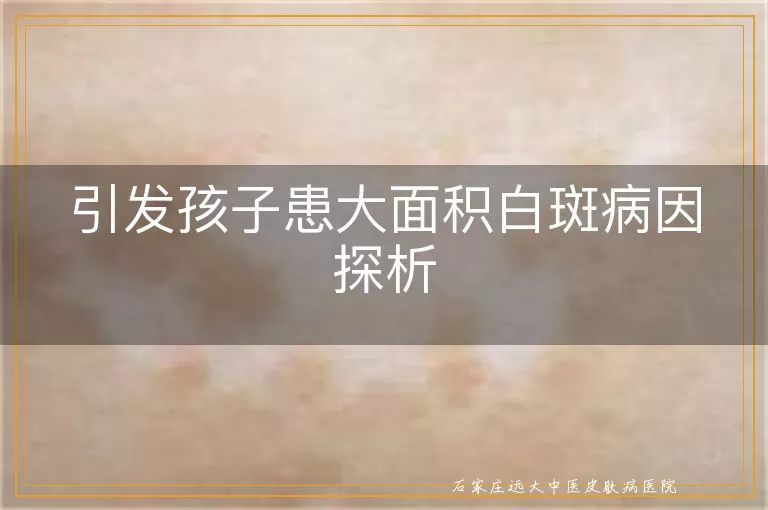 引发孩子患大面积白斑病因探析
