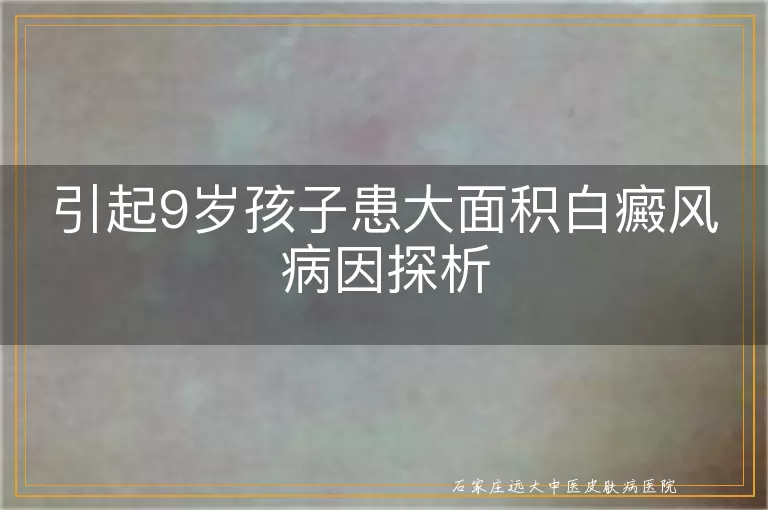 引起9岁孩子患大面积白癜风病因探析