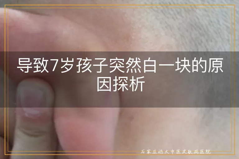 导致7岁孩子突然白一块的原因探析