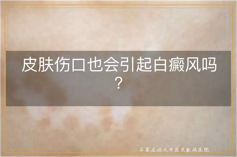 皮肤伤口也会引起白癜风吗？