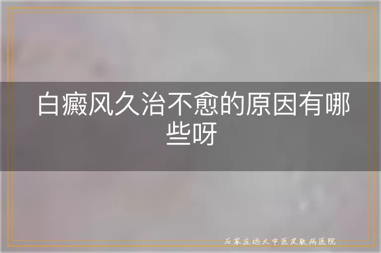 白癜风久治不愈的原因有哪些呀