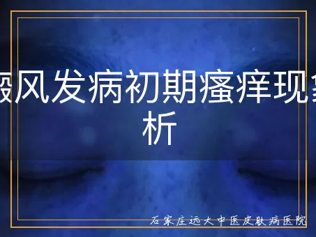 白癜风发病初期瘙痒现象探析