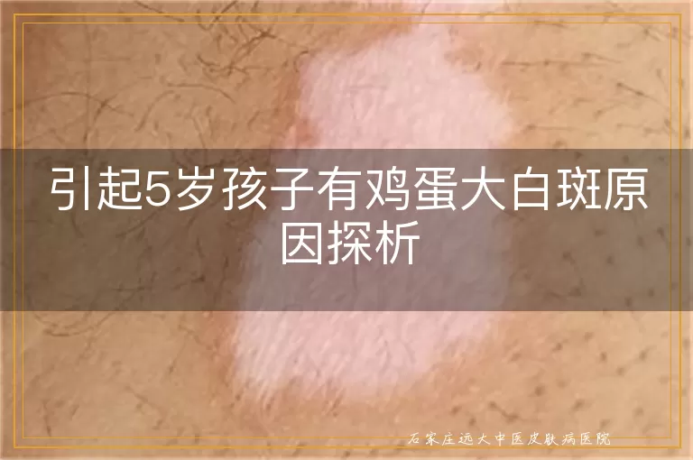 引起5岁孩子有鸡蛋大白斑原因探析