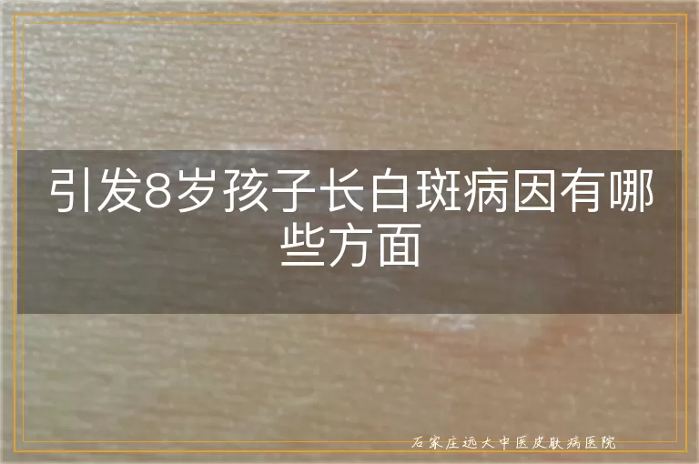 引发8岁孩子长白斑病因有哪些方面