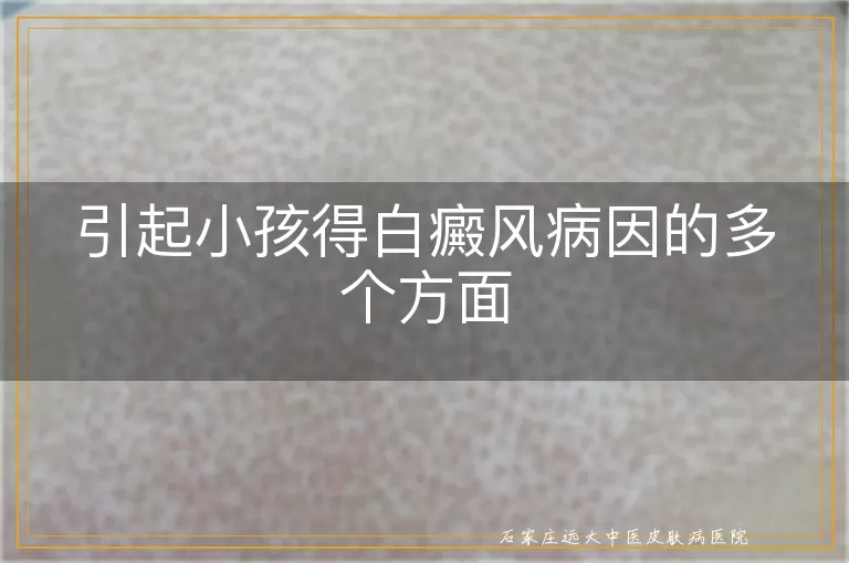 引起小孩得白癜风病因的多个方面
