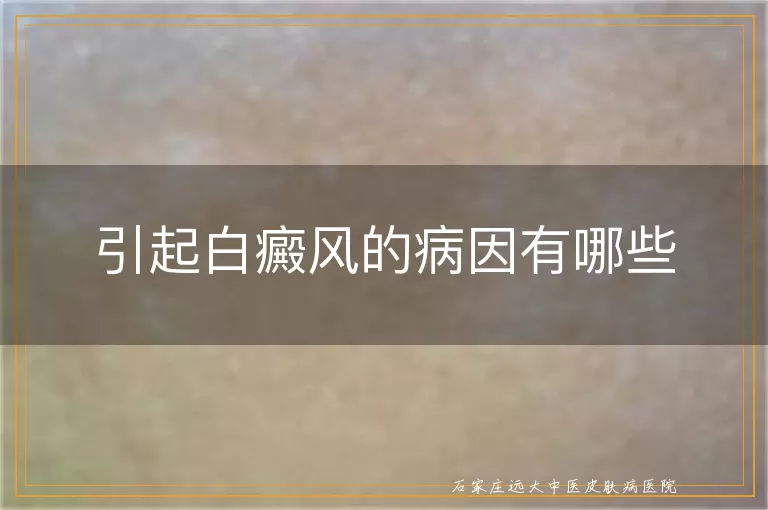 引起白癜风的病因有哪些