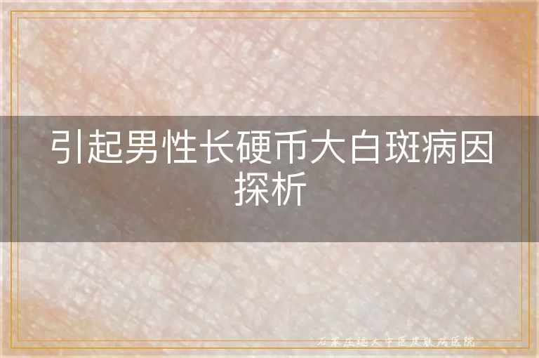 引起男性长硬币大白斑病因探析