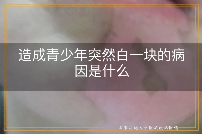 造成青少年突然白一块的病因是什么