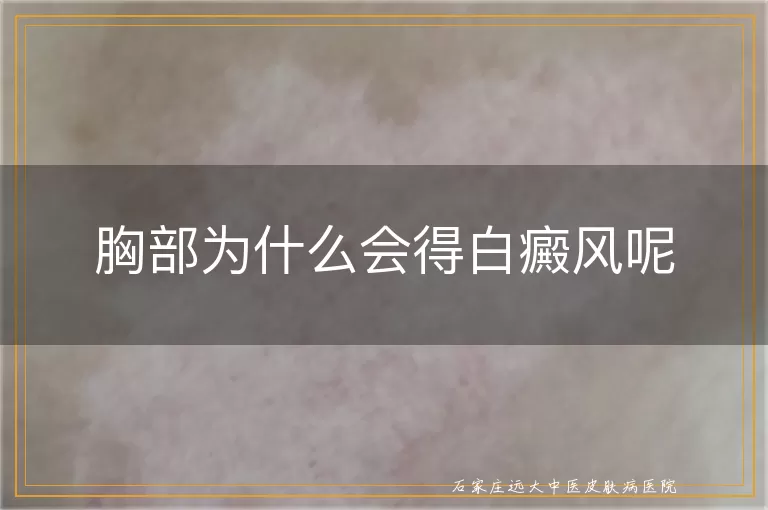 胸部为什么会得白癜风呢