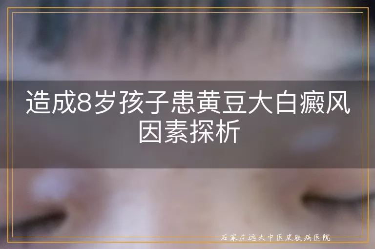 造成8岁孩子患黄豆大白癜风因素探析