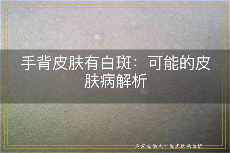 手背皮肤有白斑：可能的皮肤病解析