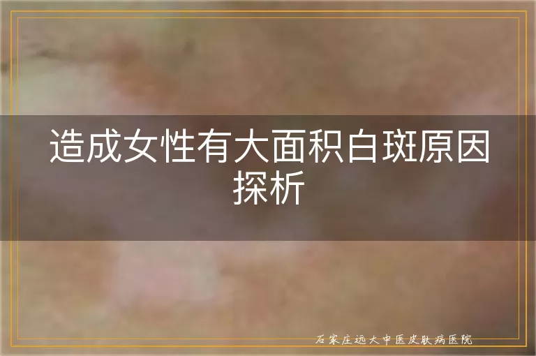 造成女性有大面积白斑原因探析