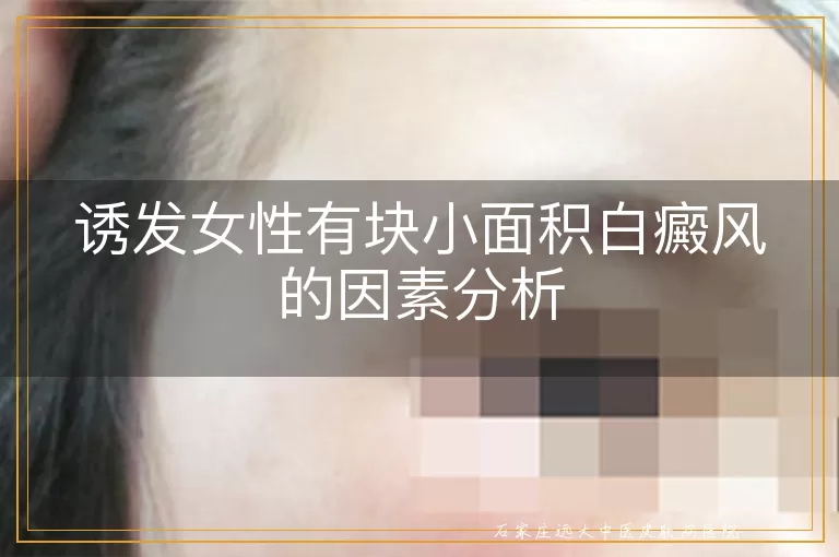 诱发女性有块小面积白癜风的因素分析