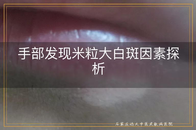 手部发现米粒大白斑因素探析