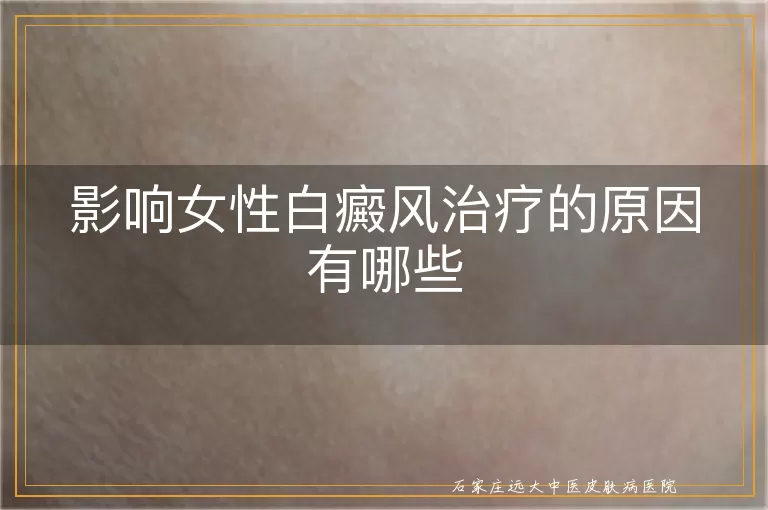 影响女性白癜风治疗的原因有哪些