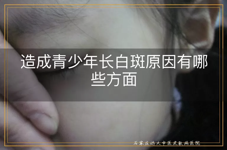 造成青少年长白斑原因有哪些方面