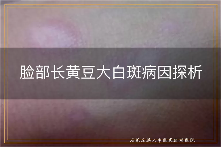 脸部长黄豆大白斑病因探析