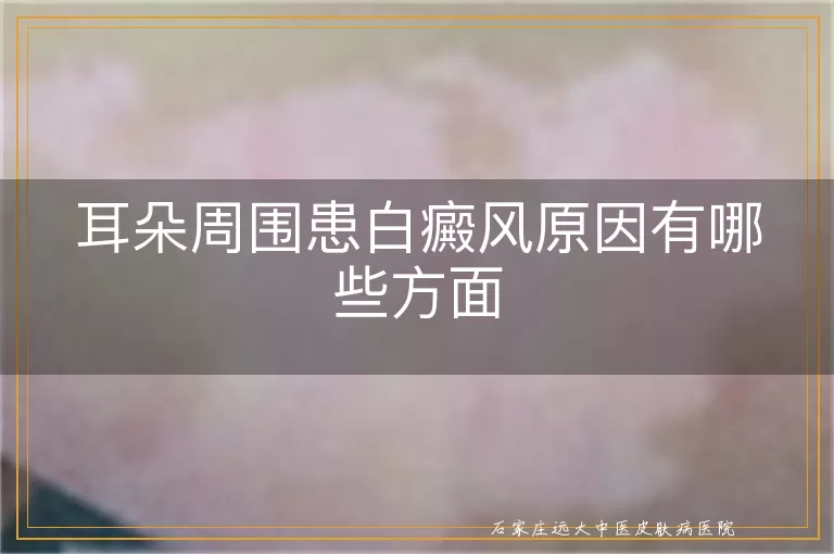 耳朵周围患白癜风原因有哪些方面
