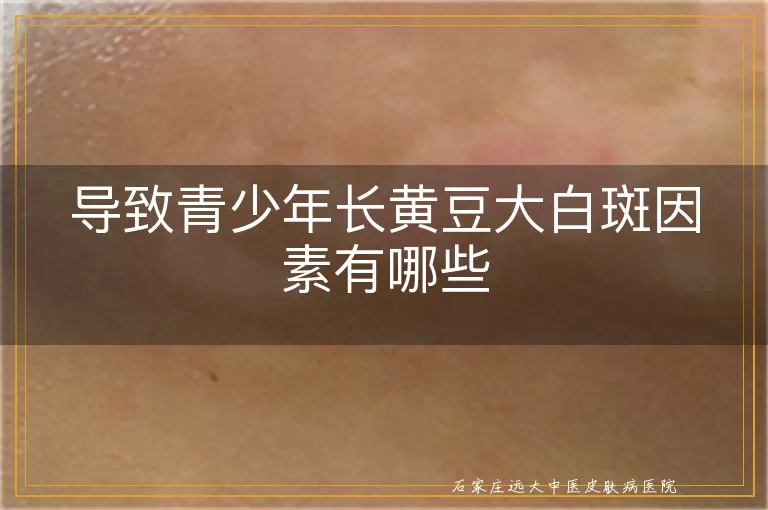导致青少年长黄豆大白斑因素有哪些