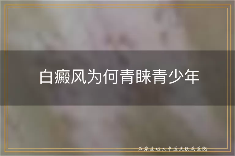 白癜风为何青睐青少年