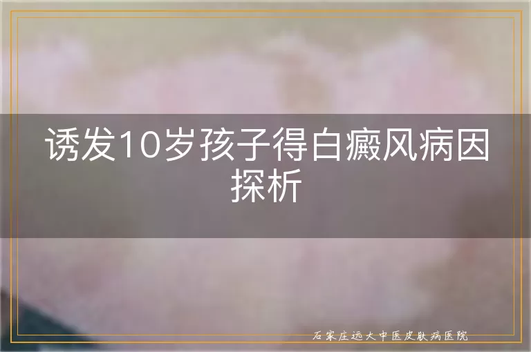 诱发10岁孩子得白癜风病因探析