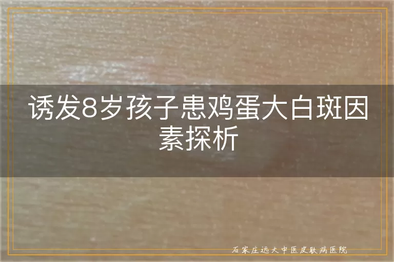 诱发8岁孩子患鸡蛋大白斑因素探析