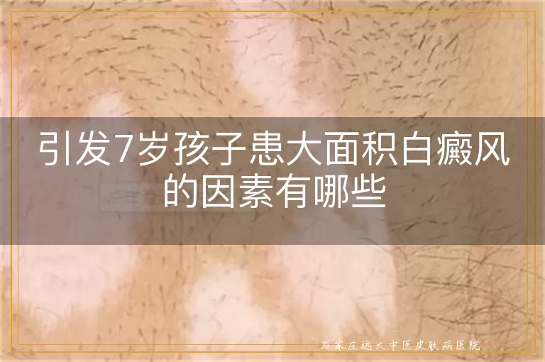 引发7岁孩子患大面积白癜风的因素有哪些