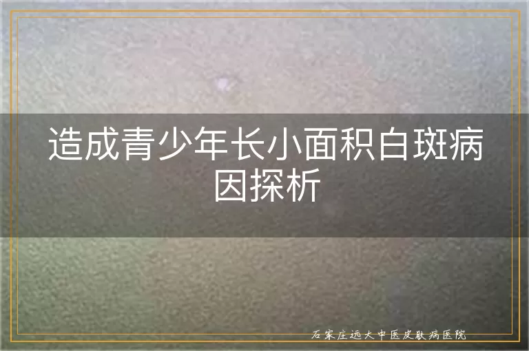 造成青少年长小面积白斑病因探析