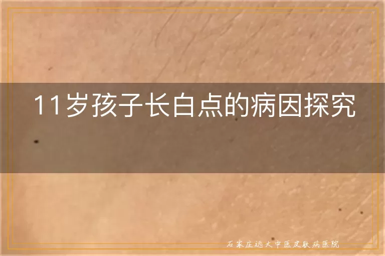 11岁孩子长白点的病因探究