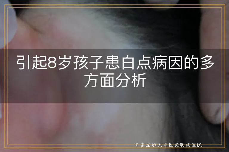 引起8岁孩子患白点病因的多方面分析