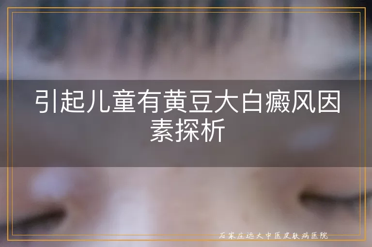 引起儿童有黄豆大白癜风因素探析