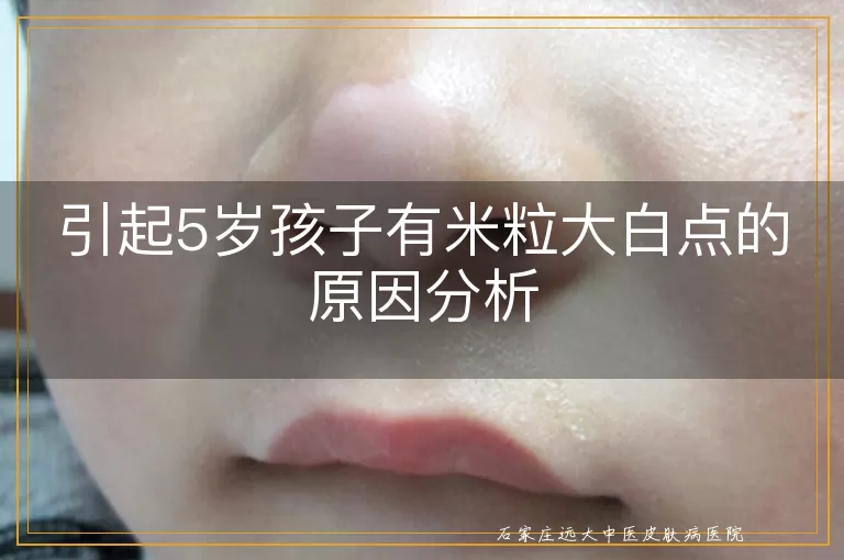 引起5岁孩子有米粒大白点的原因分析