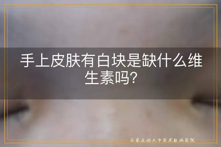 手上皮肤有白块是缺什么维生素吗？
