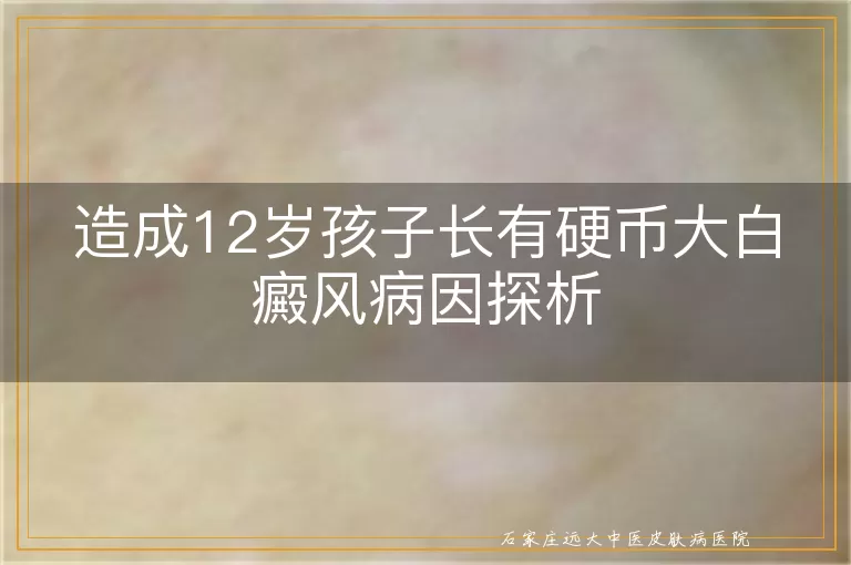 造成12岁孩子长有硬币大白癜风病因探析