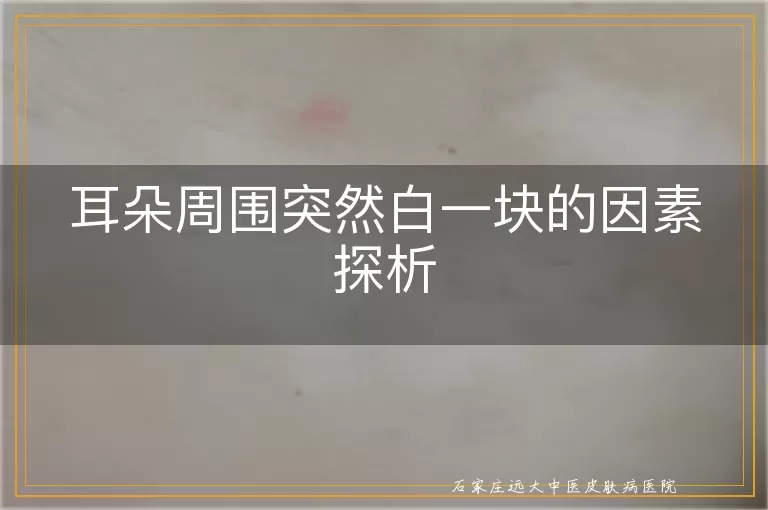 耳朵周围突然白一块的因素探析