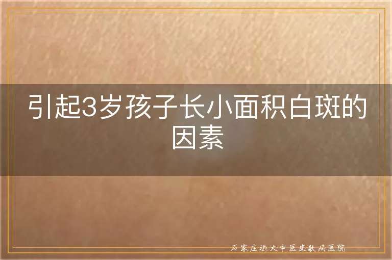 引起3岁孩子长小面积白斑的因素