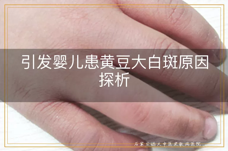引发婴儿患黄豆大白斑原因探析