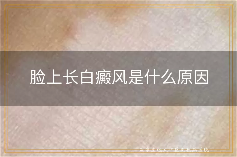 脸上长白癜风是什么原因