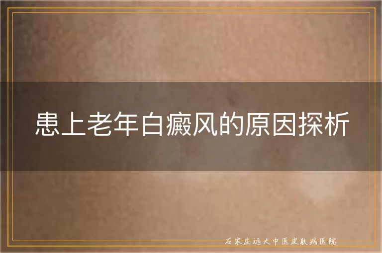 患上老年白癜风的原因探析