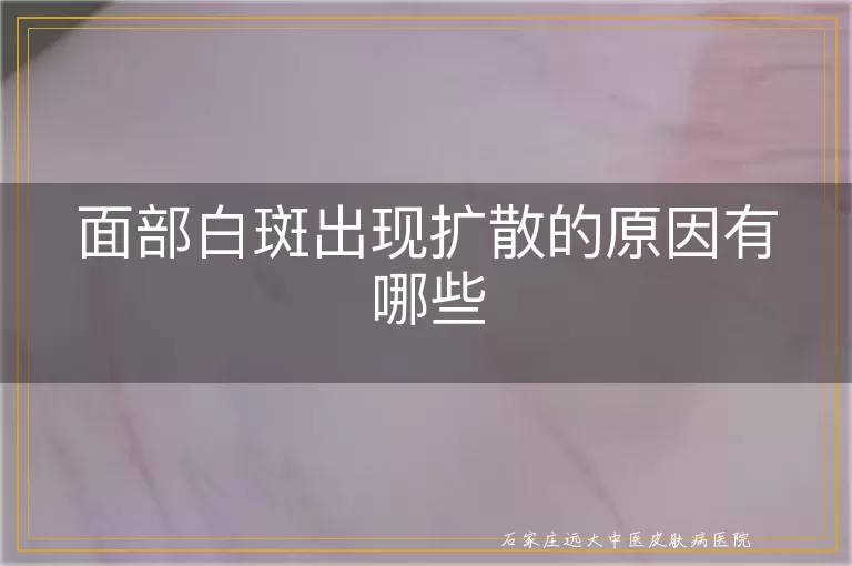 面部白斑出现扩散的原因有哪些