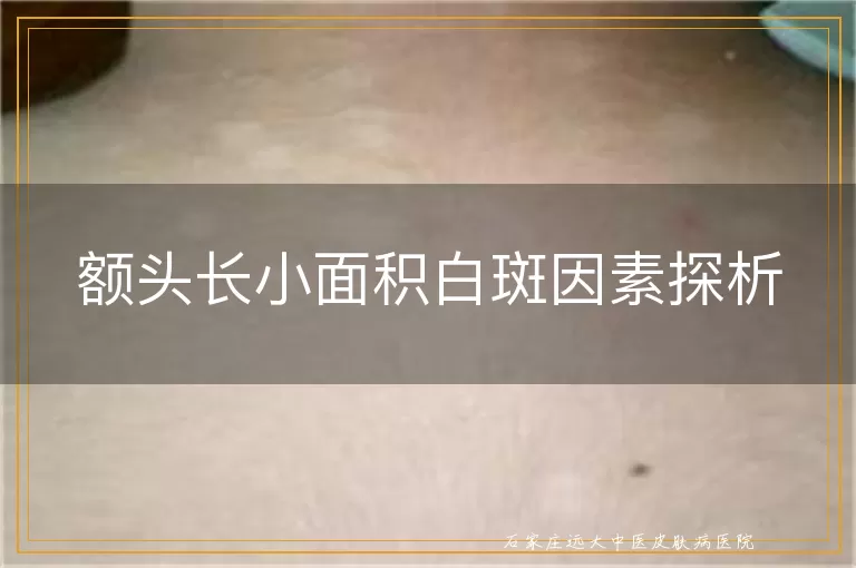 额头长小面积白斑因素探析