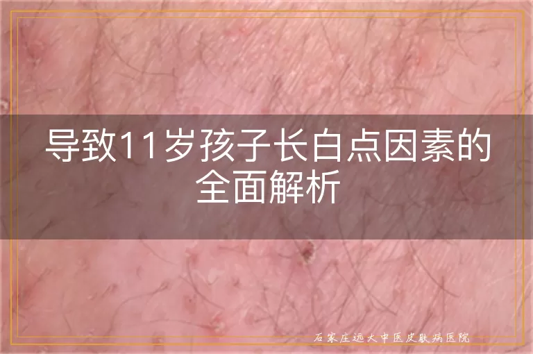 导致11岁孩子长白点因素的全面解析