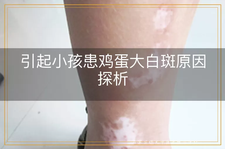 引起小孩患鸡蛋大白斑原因探析