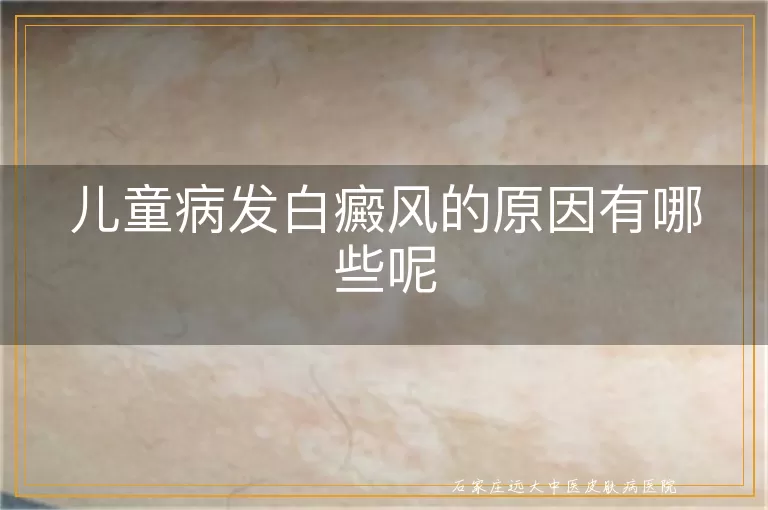 儿童病发白癜风的原因有哪些呢