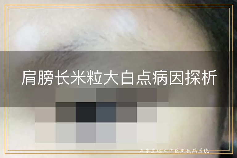 肩膀长米粒大白点病因探析
