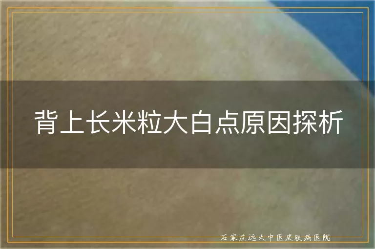 背上长米粒大白点原因探析