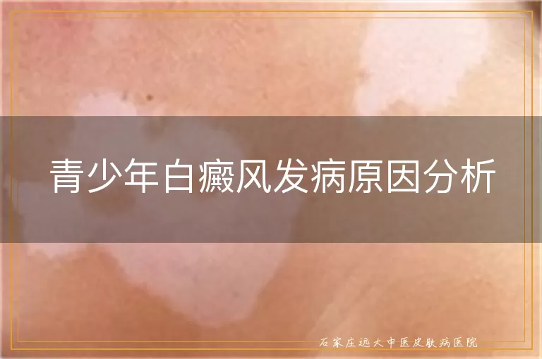 青少年白癜风发病原因分析