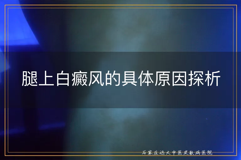 腿上白癜风的具体原因探析