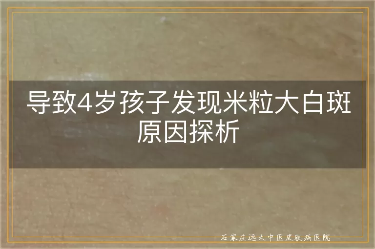 导致4岁孩子发现米粒大白斑原因探析